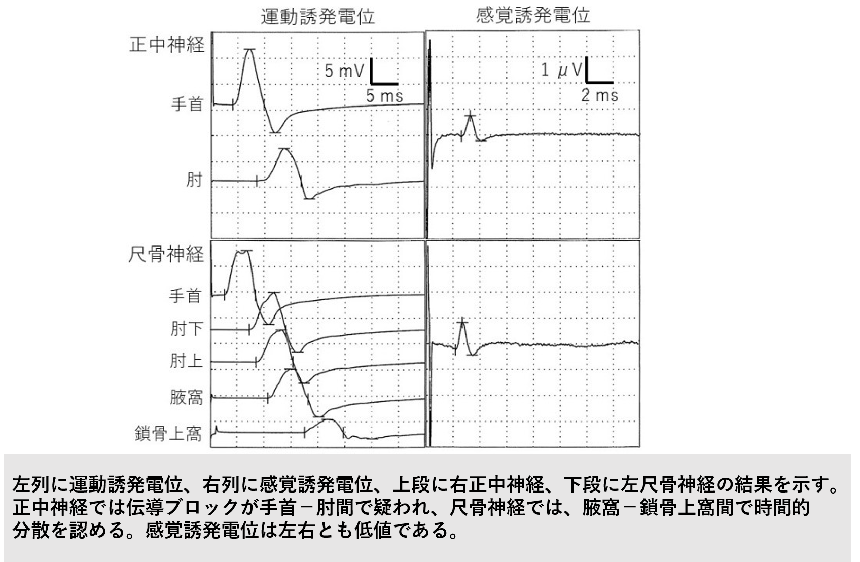 働きたい気持ちに応える、神経難病治療と仕事の両立へ