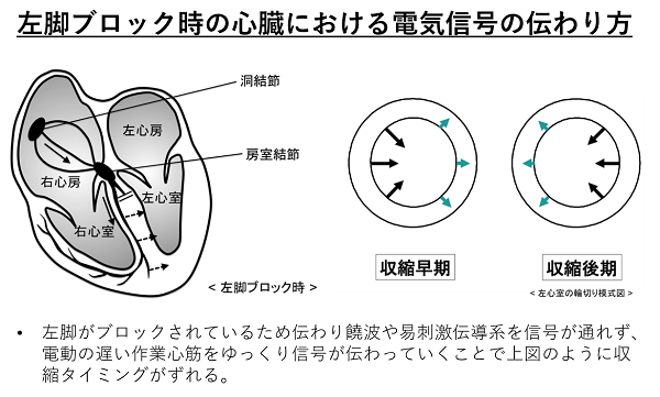患者さんに寄りそう植込み型心臓電気デバイス(CIEDs)治療を 患者さんに寄りそう植込み型心臓電気デバイス(CIEDs)治療を